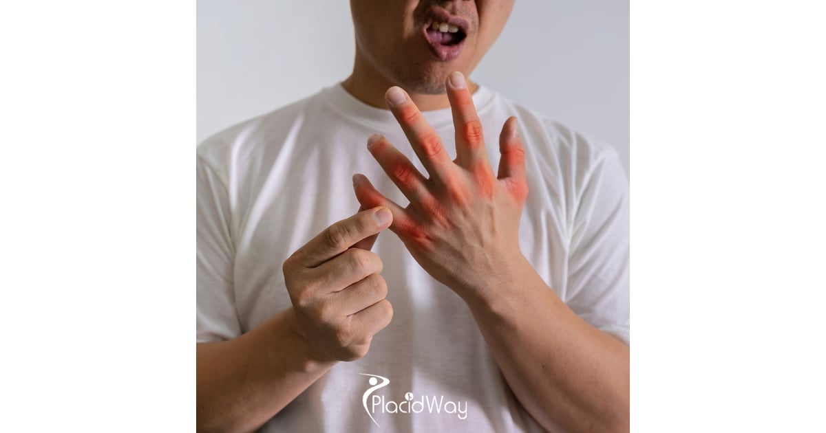 Pain-Free Dexterity: Indonesians Avoid Surgery with Tokyo’s Stem Cell Injections for Hand and Wrist Function Recovery