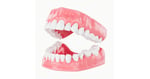 Implantes Dentales En Mexico Precios - 2026