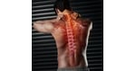 Slovakia's Emerging Stem Cell Treatments for Spinal Cord Injuries: Insights for Romanian Patients