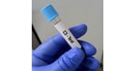 Stem Cell Therapy for Autoimmune Diseases in Turkey: Understanding Regenerative Medicine Research and Patient Considerations