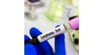 From Diagnosis to Remission: How CAR T-Cell Therapy Fights Lymphoma
