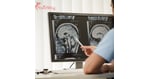 Solid Tumors and CAR T-Cells: Can This Therapy Work Beyond Blood Cancers?