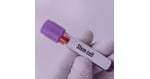 Stem Cell Therapy in Guadalajara: What the Whole Trip May Cost