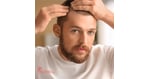 Hair Transplantation in Turkey: Restore Your Hairline with World-Class Expertise for Australian Patients