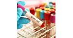 Stem Cell Therapy Germany vs USA: Your Guide to Regenerative Treatments