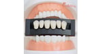 Why Kiwis are Choosing Thailand for Dental Veneers: A Comprehensive Guide
