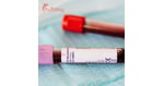 What to Expect from Stem Cell Treatments Abroad: Costs, Risks, and Recovery