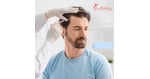 Stem Cell Hair Transplant in Malaysia: The Complete Guide