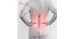 Advanced Stem Cell Therapy for Failed Back Surgery Syndrome (FBSS) in India