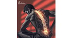 Spine Arthritis Stem Cell Therapy in Mexico for Patients from Brazil Wanting to Move Without Pain
