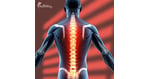 Rise Beyond Limits: Spinal Cord Injury Stem Cell Therapy in Malaysia Giving Hope to Patients from India
