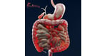 Advanced Crohns Disease Stem Cell Therapy in Japan: A Complete Guide