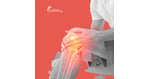 Stem Cell Treatment for Joint Pain in Turkey for Munich Patients 