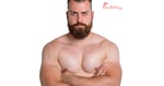 Gynecomastia Surgery in Mexico for Male Chest Confidence and Body Image Improvement
