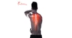 6 Reasons to Choose Spine Surgery in Warsaw, Poland