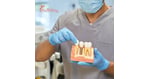 From Almaty to Tbilisi: The Rise of Kazakhstan Patients Seeking Expert Dental Implants in Georgia