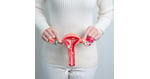 Ovarian Rejuvenation in Mexico City: 4 Cost Comparisons for US Women Exploring Stem Cell Therapy