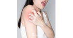 6 Facts for US Patients on Intravenous Stem Cell Therapy for Lupus in Colombia