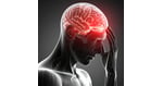 The Dopamine Defense: How Bogota’s Neuro-Regenerative Hubs are Halting Disease Progression in Global Patients