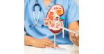 Integrative Kidney Cancer Treatment in Tijuana - Preserving Renal Function
