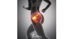 Hip Replacement Surgery in Mexico: Affordable, Reliable Surgery for California Tourists