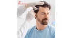 Best Countries for Hair Transplant Surgery in 2026