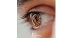 Evaluating LASIK Eye Surgery in Mexico: Safety, Costs, and What Patients Need to Know