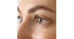 Considering a Brow Lift in Mexico? A Complete Patient Guide to Safety, Surgeon Credentials, and Costs