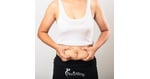 What to Know Before Choosing Bariatric Surgery in Mexico