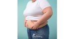 Bariatric Surgery in Turkey for Ontario Residents