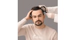 Hair Transplant in Turkey vs the UK: Hidden Costs Checked Line by Line