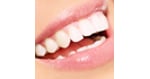 Implantes dentales en San José, Costa Rica - $700