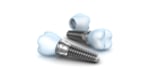 Dental Implants in Dubai Get Affordable