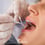 Orthodontic Treatment in Gangnam, South Korea: Braces With Cross-Border Follow-Up
