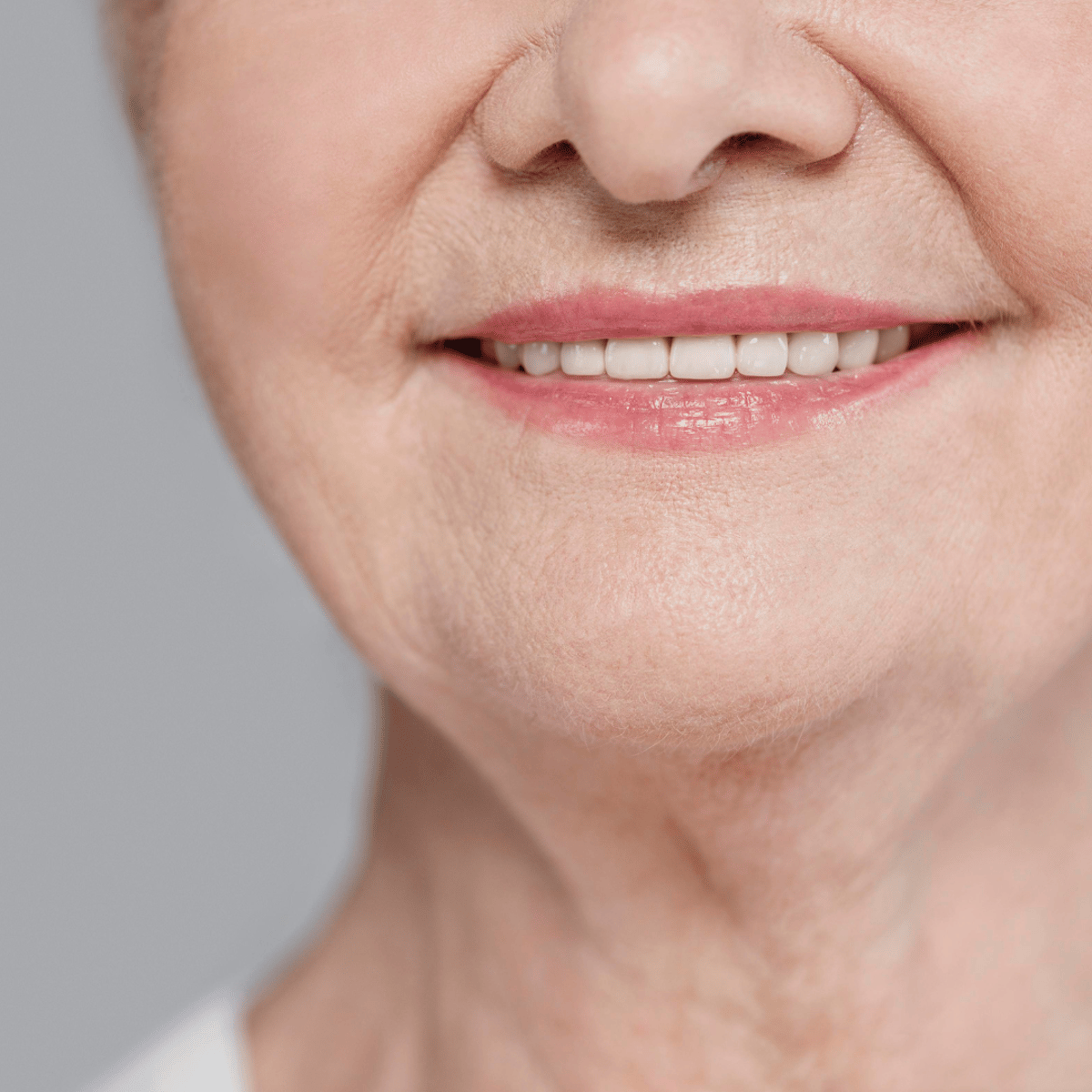 Veneers Cost in Turkey - Best Dental Clinics & Prices