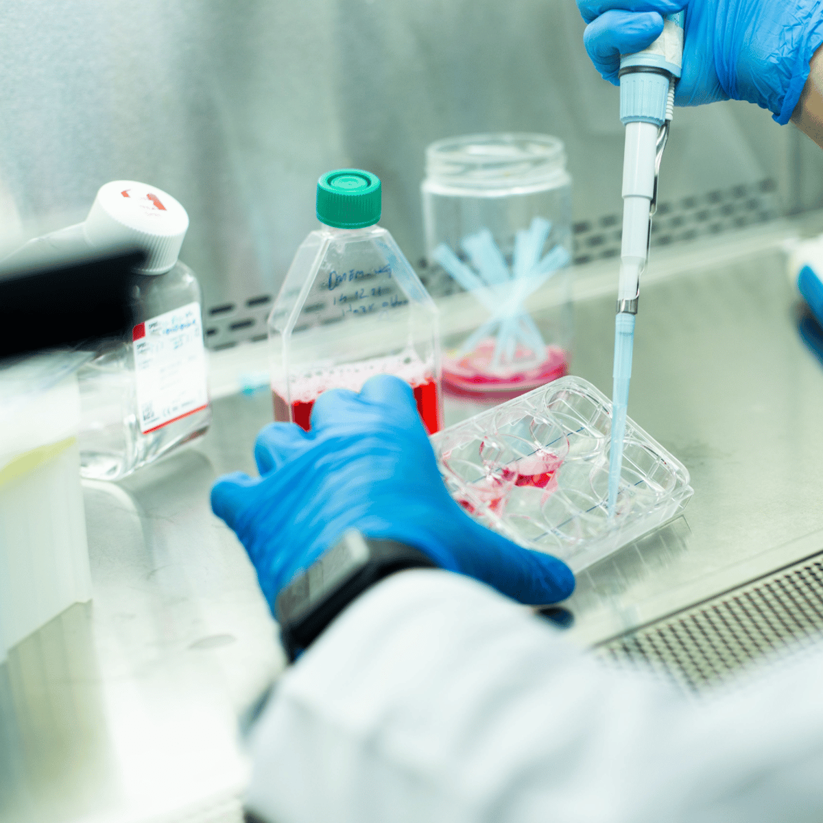 Kosten für Stammzelltherapie en Viena, Austria