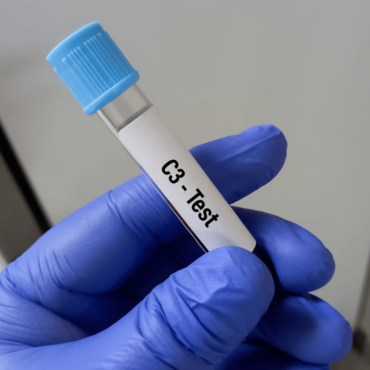 Рост медицинского туризма в Турции: экзосомы и стволовые клетки для лечения аутоиммунных заболеваний