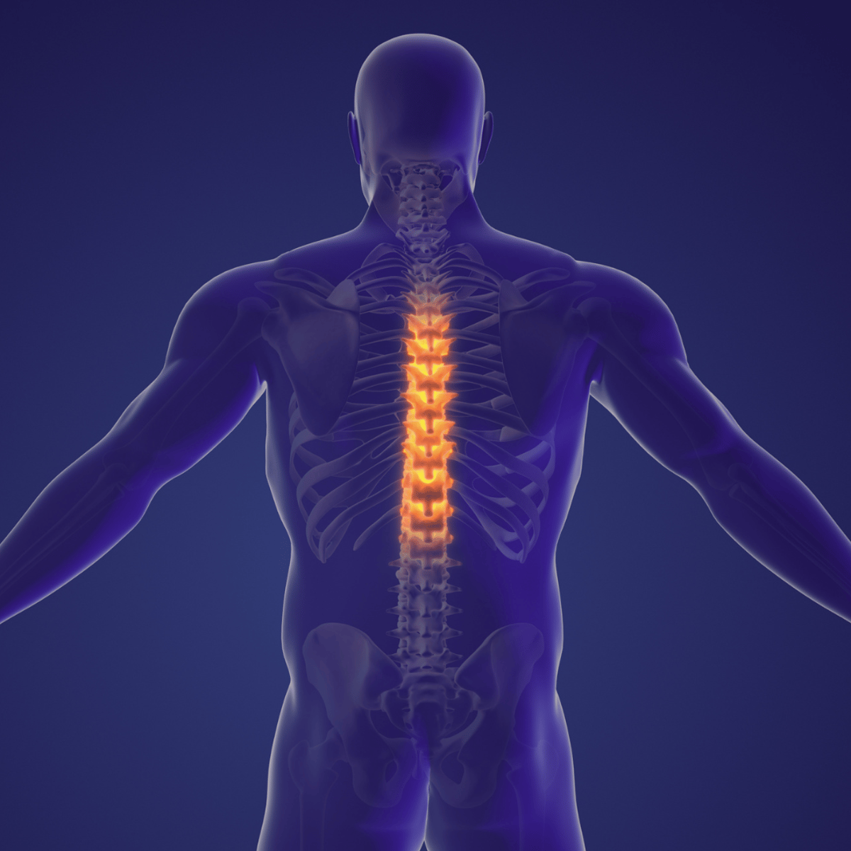 Avoid Long Wait Times for Spinal Fusion Surgery and Discectomy: Choose Mexico