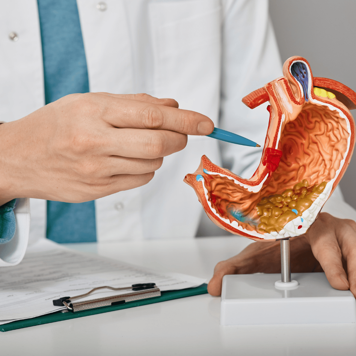 Cómo los canadienses pueden ahorrar mucho en la cirugía de manga gástrica viajando a Tijuana