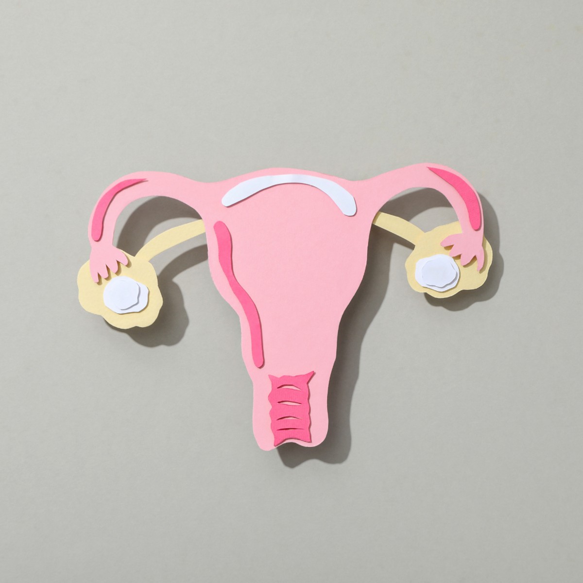 Polycystic Ovary Syndrome (PCOS) and Fertility: How Embryo Transfer in Cyprus Offers New Hope