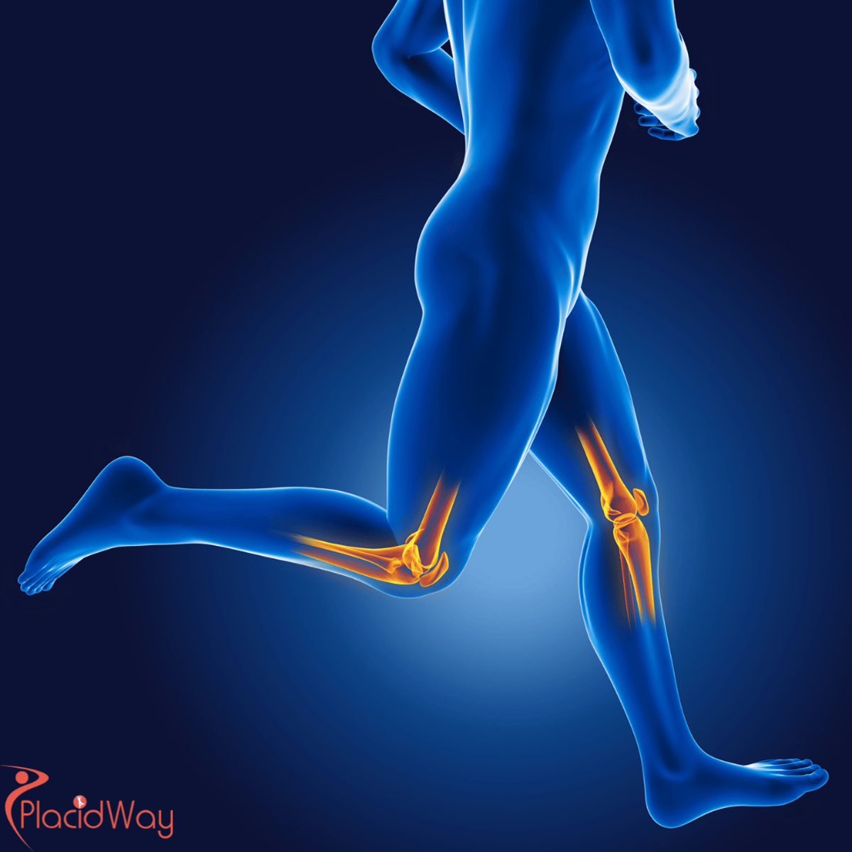 Slovakia's Innovative Approach: Enhancing Orthopedic Healing with Exosome-Enriched Stem Cell Therapies