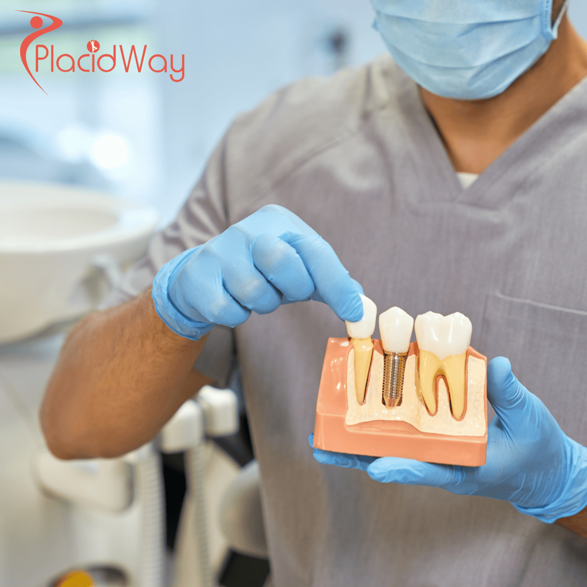 Affordable Dental Implants in Mexico: A Growing Trend Among Canadians