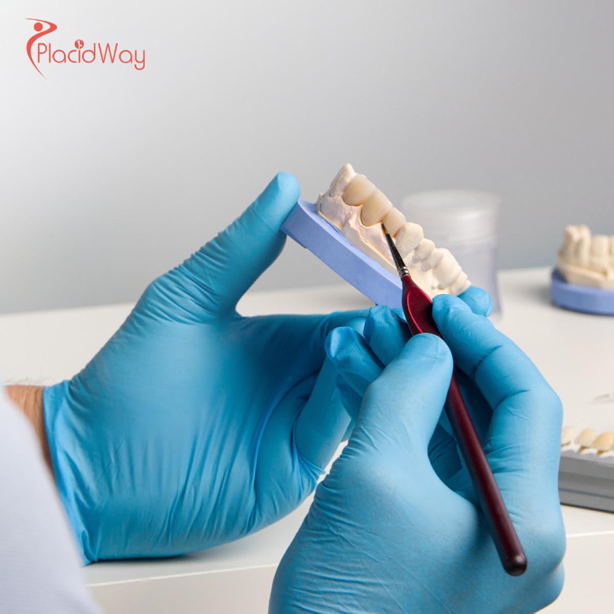 Dental Crowns in Turkey: Affordable and Expert Dental Solutions for Australians