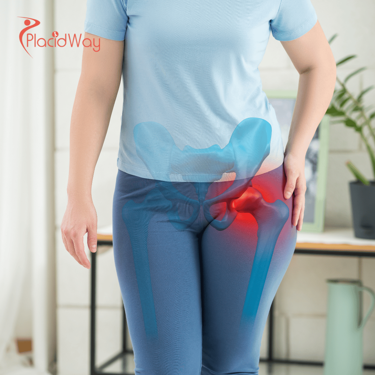 Hip Replacement Surgery in Turkey: Cost-Effective Orthopedic Care for Australian Tourists