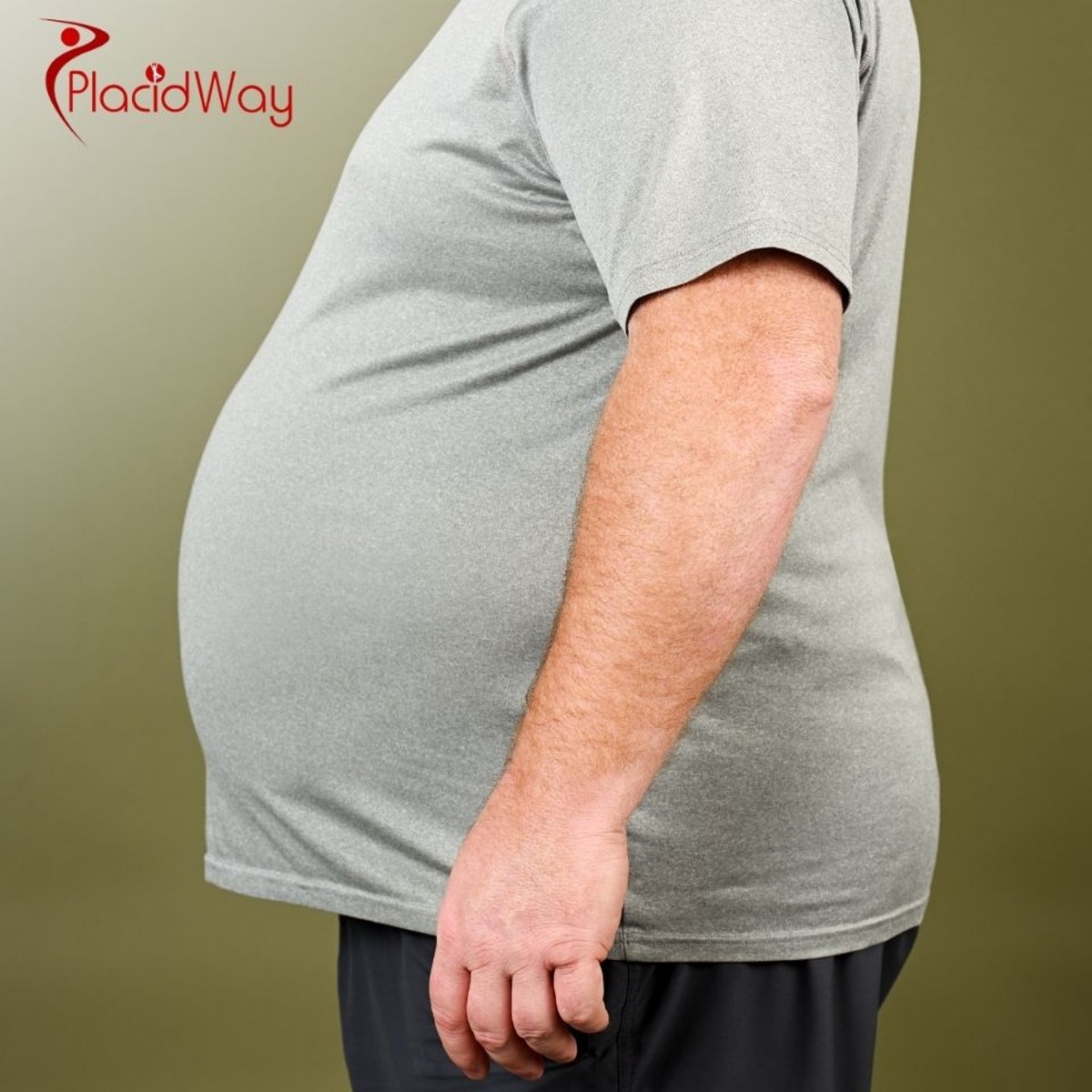 Gastric Bypass in Turkey: Understanding the Procedure and Long-Term Success