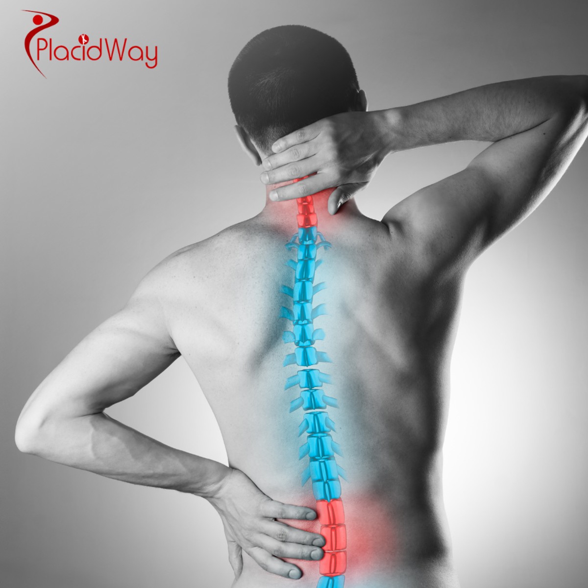 Herniated Disc Surgery in Turkey: A UK Guide to Microdiscectomy