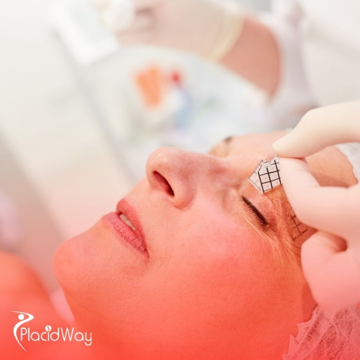 Eyelid Surgery in South Korea: Double Eyelid Surgery for U.S. Patients Seeking Affordable Solutions