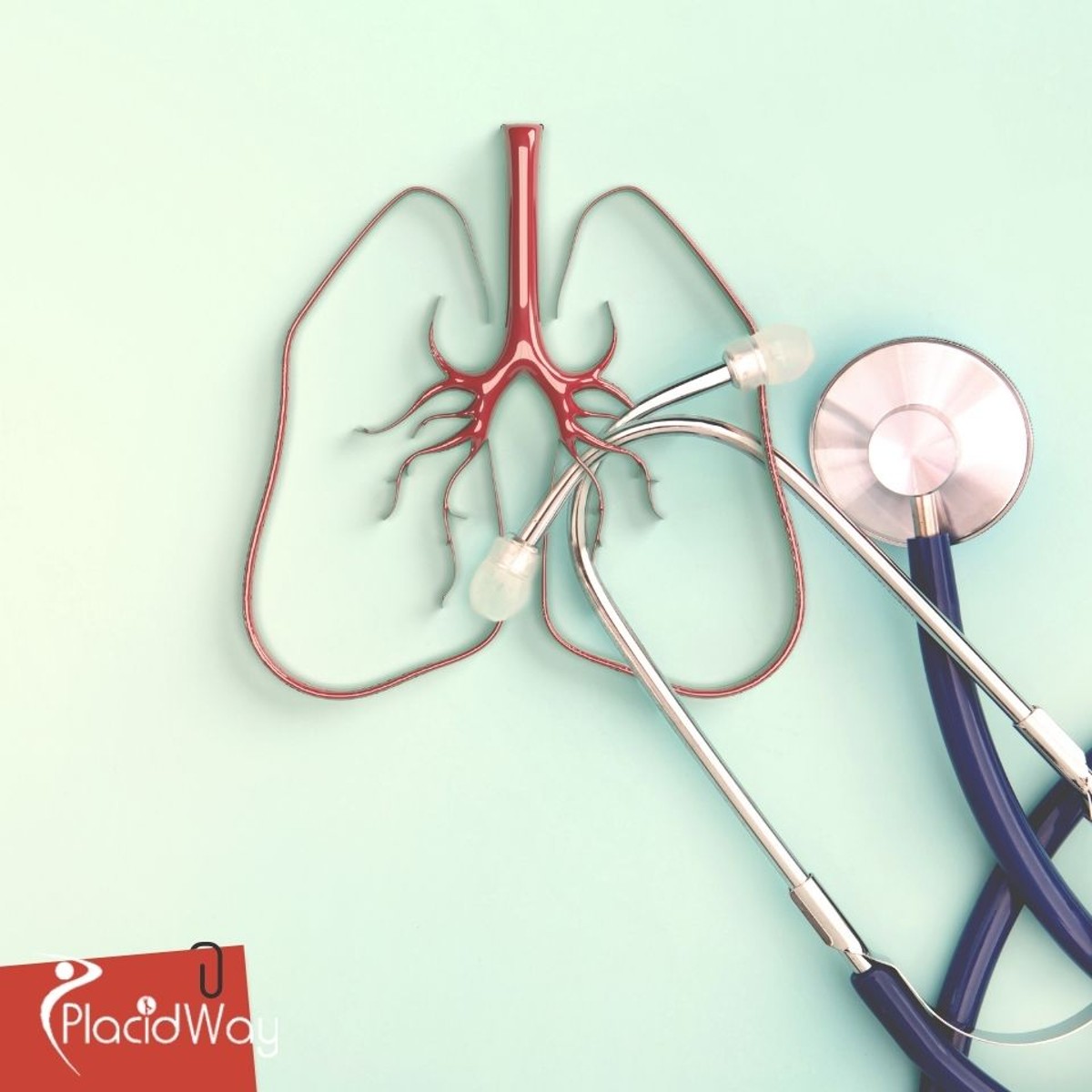 Lung Cancer Surgery in Turkey: What British Patients Should Know About Thoracic Oncology