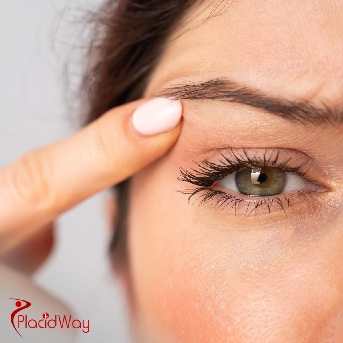 Eyelid Surgery in Turkey: Blepharoplasty for German Patients Looking to Enhance Their Eyes