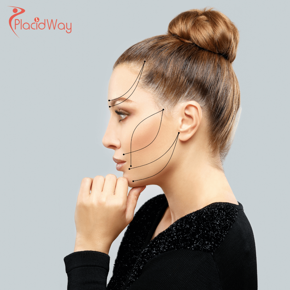 Facelift-OP in der Türkei: Wie deutsche Patienten mit einer Rhytidektomie ein jugendliches Aussehen erreichen